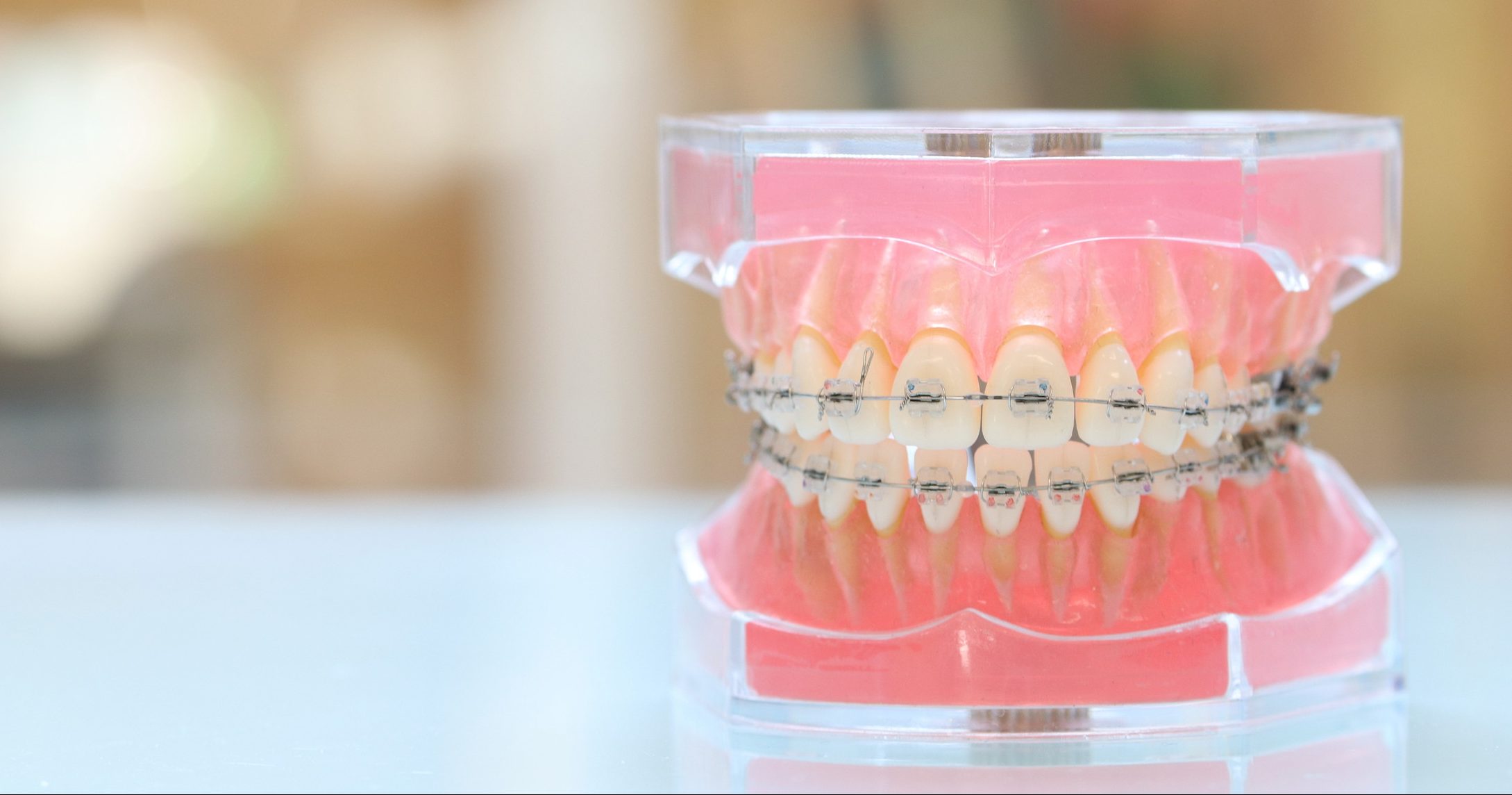 矯正歯科 イメージ